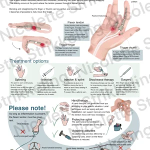 Triggerfinger (Engels)